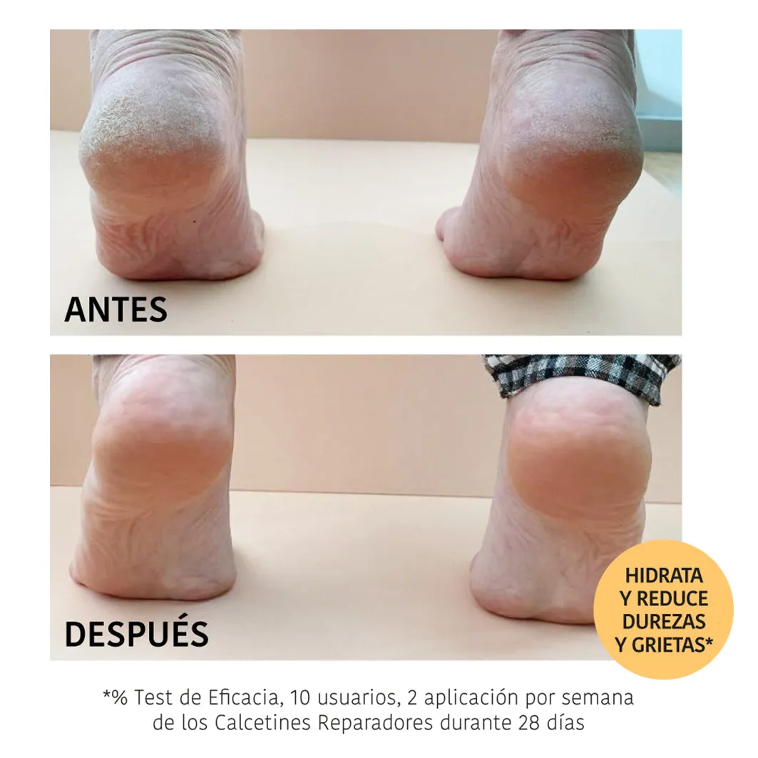 Irohanature Repair Peach maschera piedi pesca effetto sauna