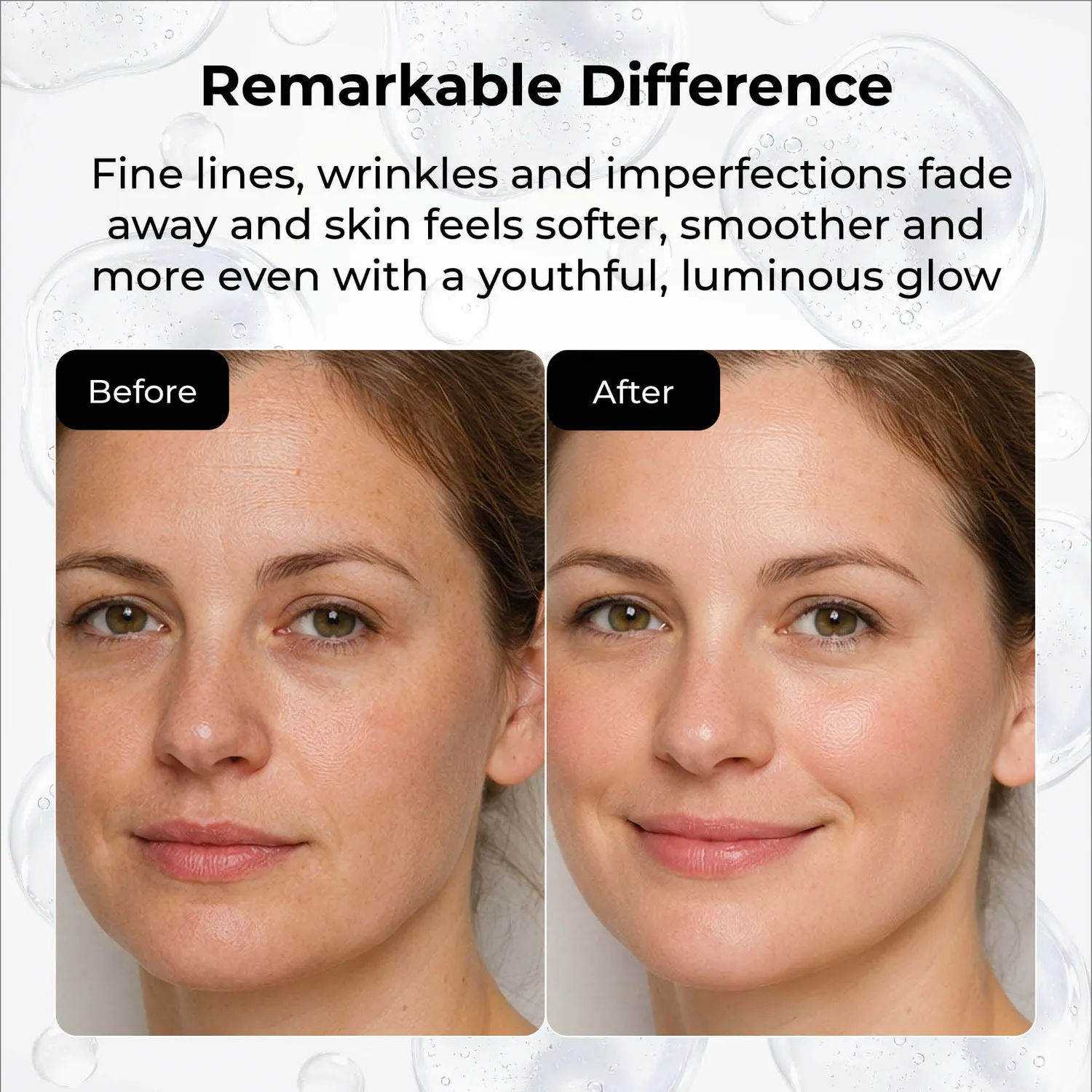 Starskin PRO Micro-Filler maschera viso 2 fasi rimpolpante