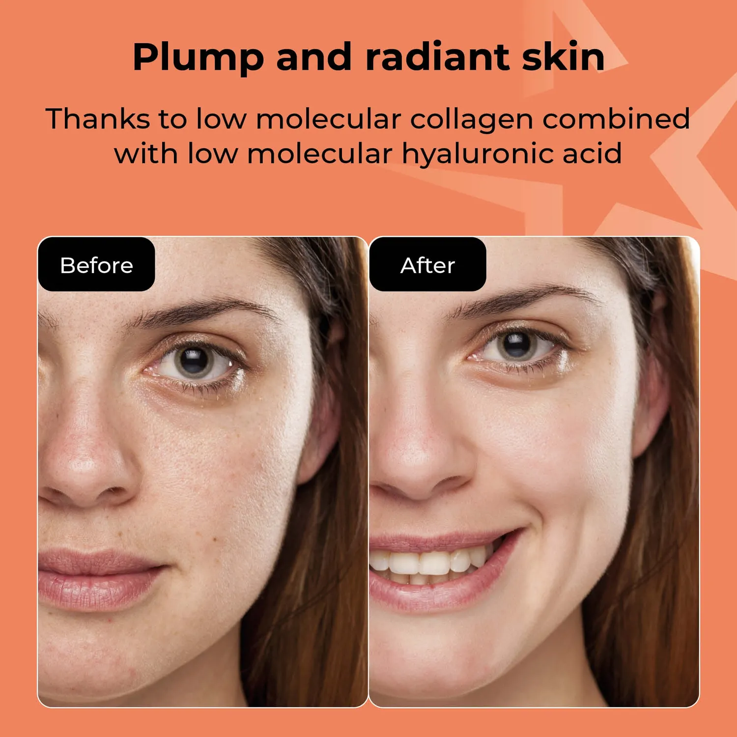 Starskin Essentials Collagen PDRN Salmon DNA maschera viso 4 pezzi