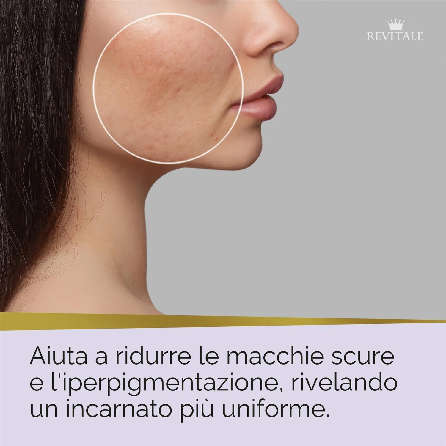 Revitale Advanced Sapone Acido Azelaico Saponetta Viso Niacinamide