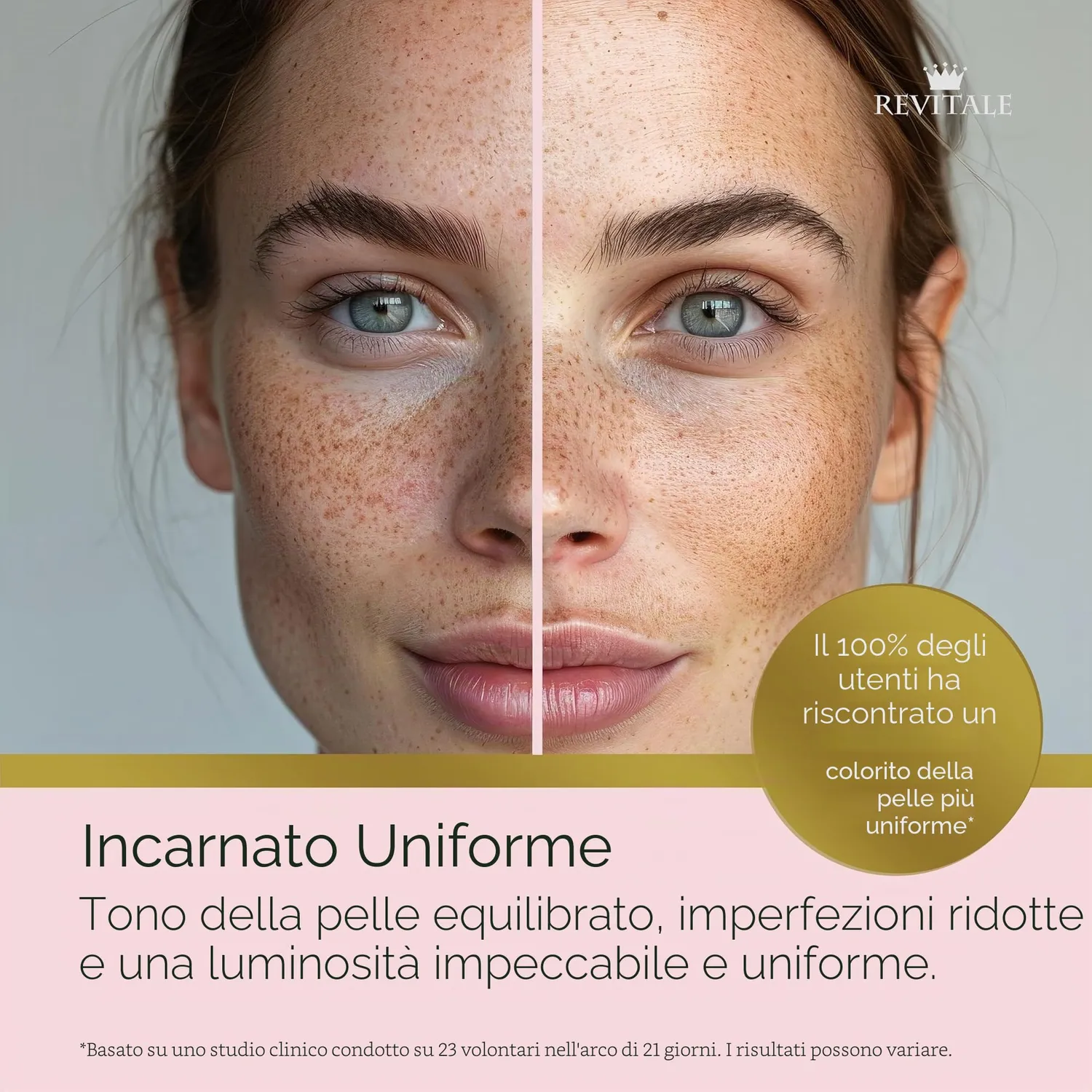 Revitale Advanced Acido Salicilico crema 80 g imperfezioni