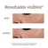 Iroha Nature Gold & Peptides patch occhi oro antirughe