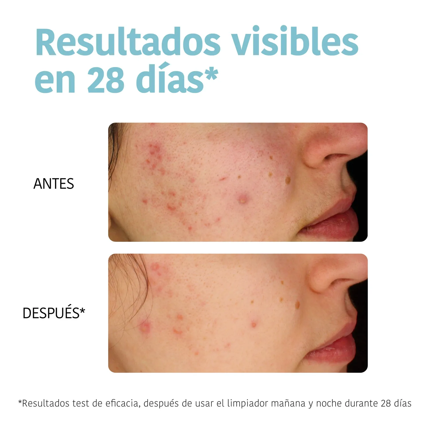 Iroha Nature Purifying gel detergente acne