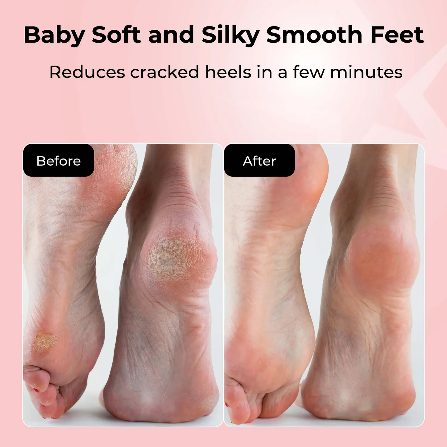 Starskin Foot Peeling Mist spray piedi calli acido glicolico 100ml