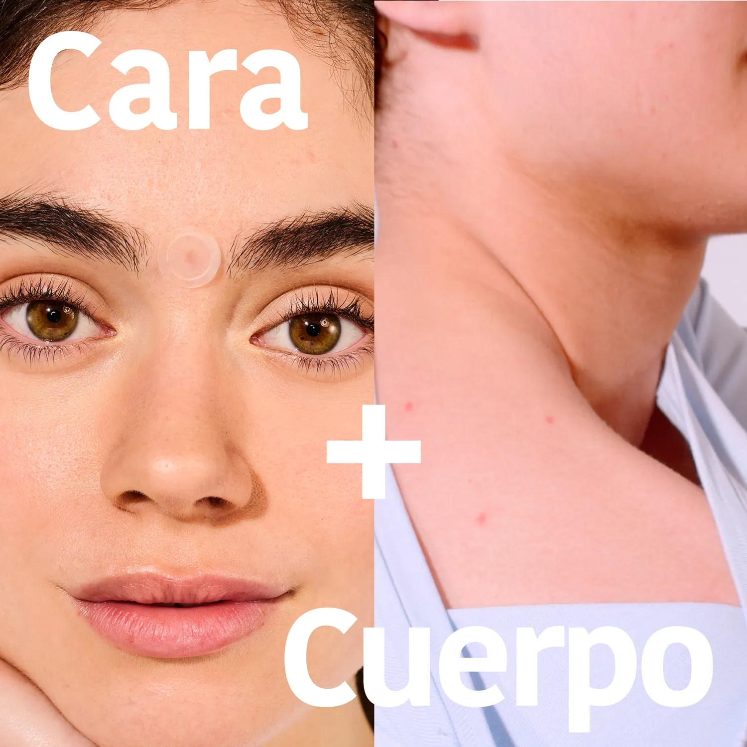 Irohanature Microdarts Pimple Patches Acido Salicilico Brufoli