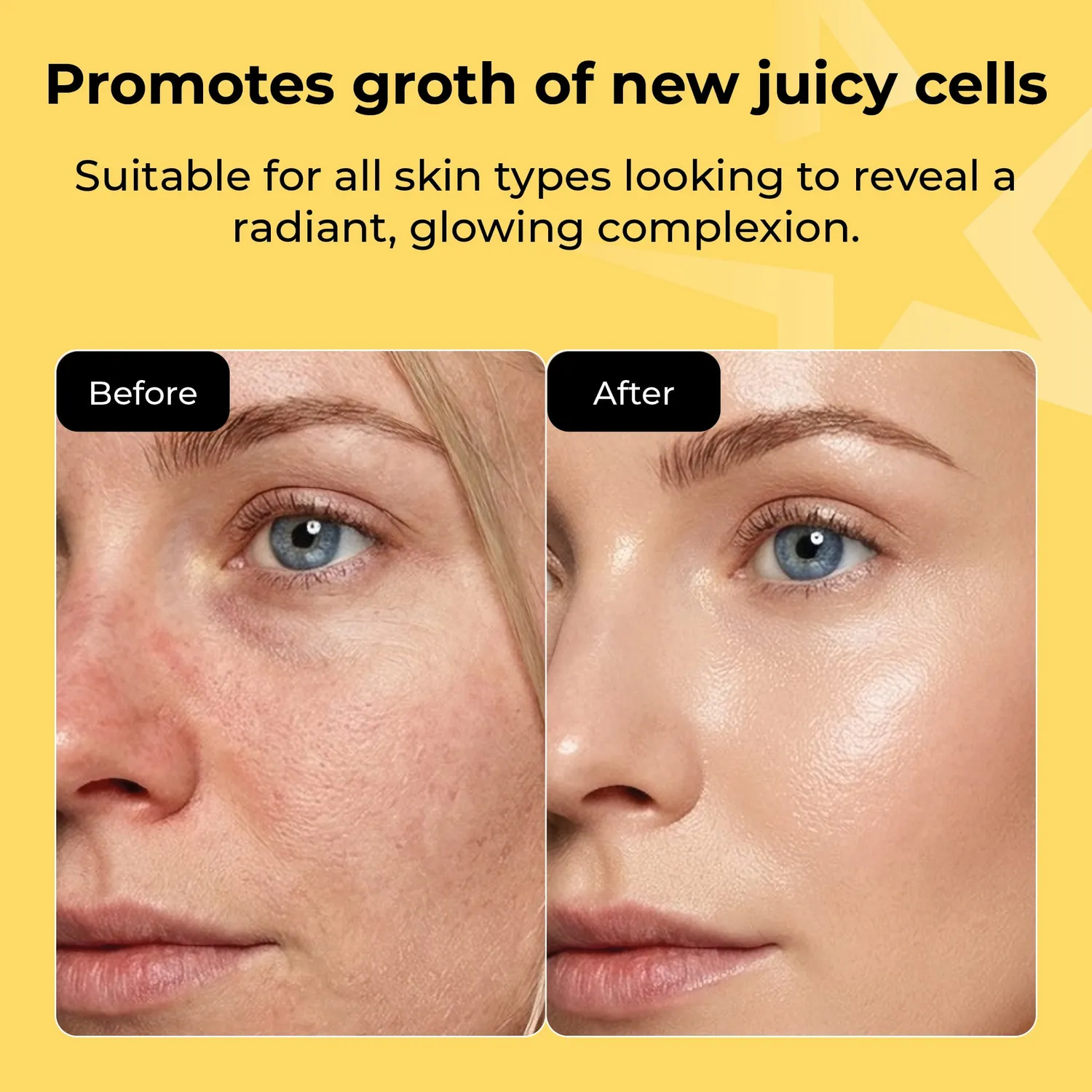 Starskin Essentials Glowstar Peeling Puff spugna esfoliante viso