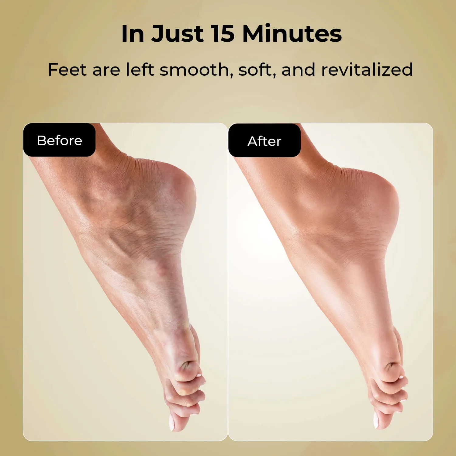 Starskin The Gold Mask Foot maschera piedi 15 min