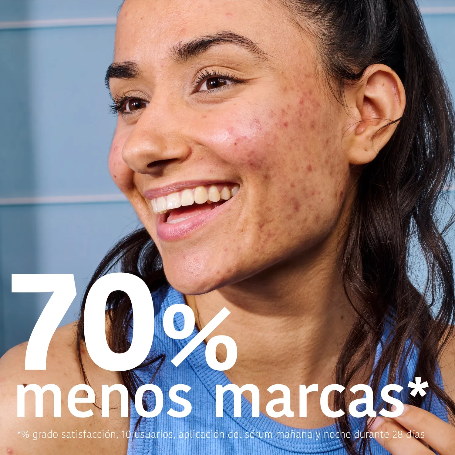 Irohanature Prevent & Correct Anti-Blemish siero acne niacinamide