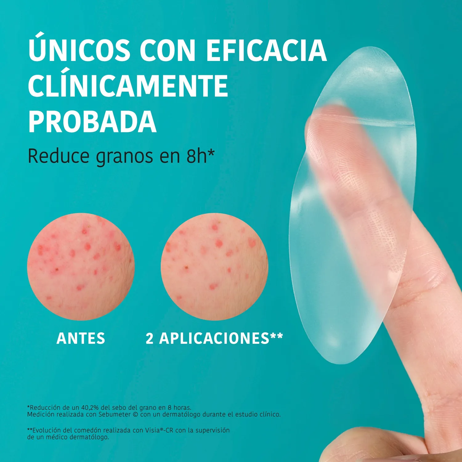 Irohanature XL Pimple Patches Cerotti Brufoli Acido Salicilico