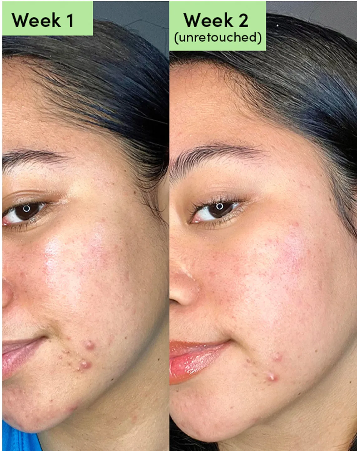 Sand & Sky Oil Control Clearing Face Mask maschera purificante