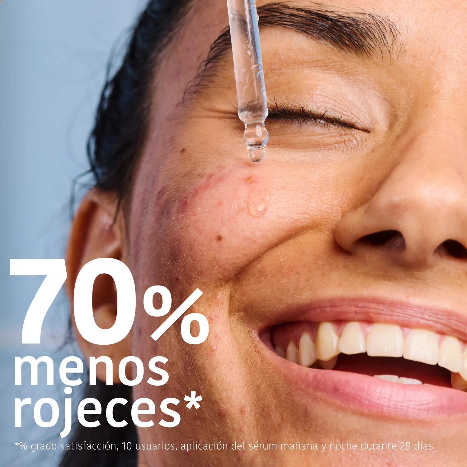 Irohanature Prevent & Correct Anti-Blemish siero acne niacinamide