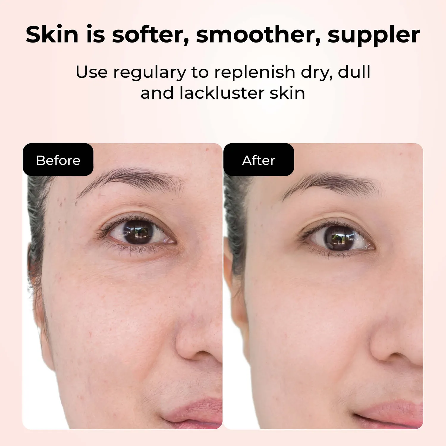 Starskin Pink Cactus Mask 3+1 maschera lenitiva