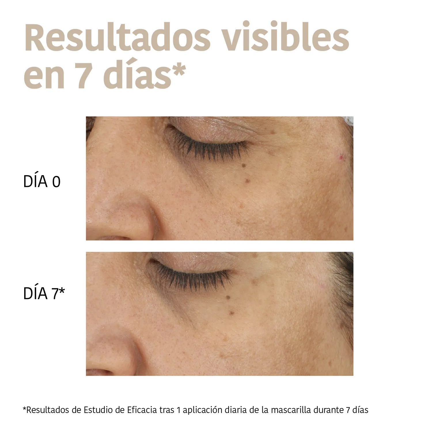 Iroha Nature Dark Spots Mask Tranexamic Acid maschera antimacchia