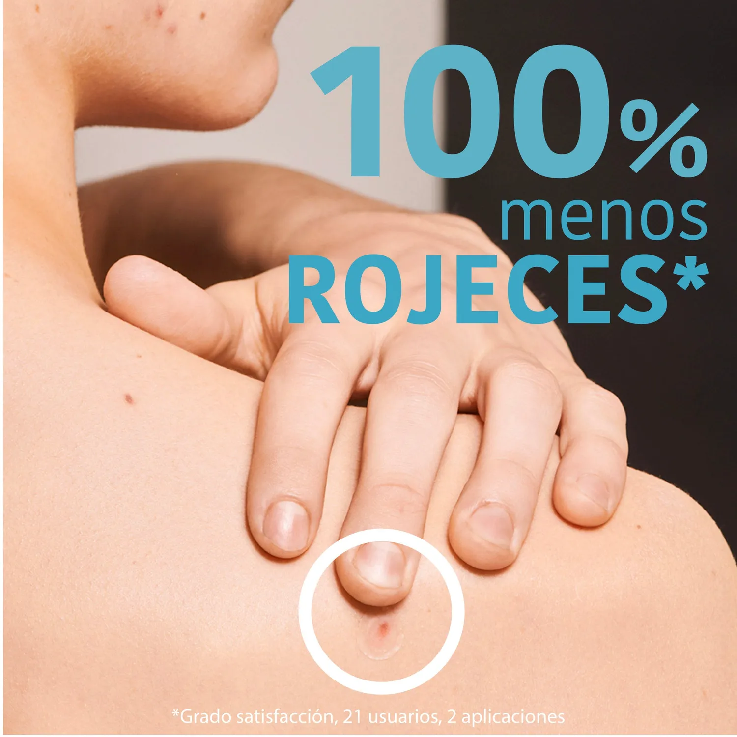 Iroha Nature SOS Pimple Patches cerotti brufoli 90 pezzi