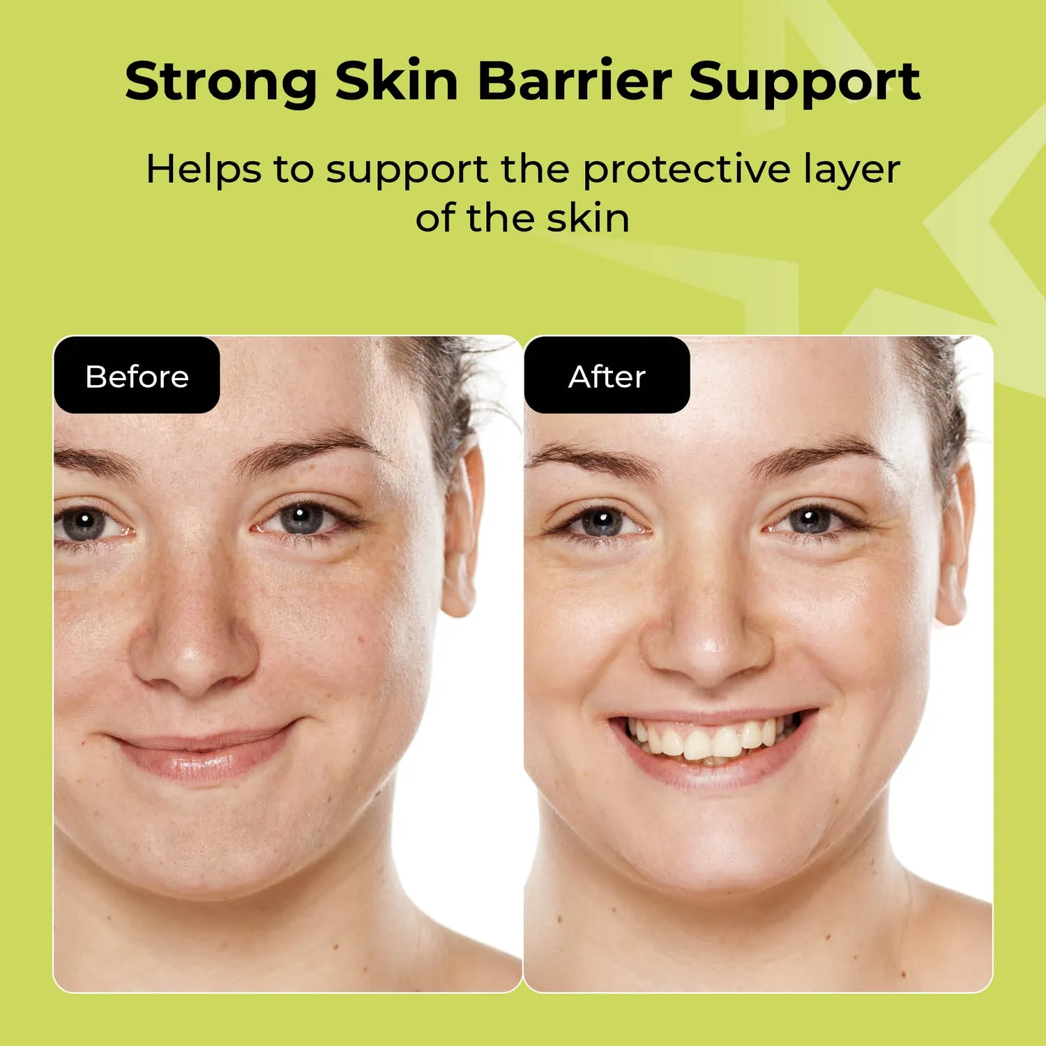 Starskin Collagen Green Caviar maschera idrogel 30 minuti