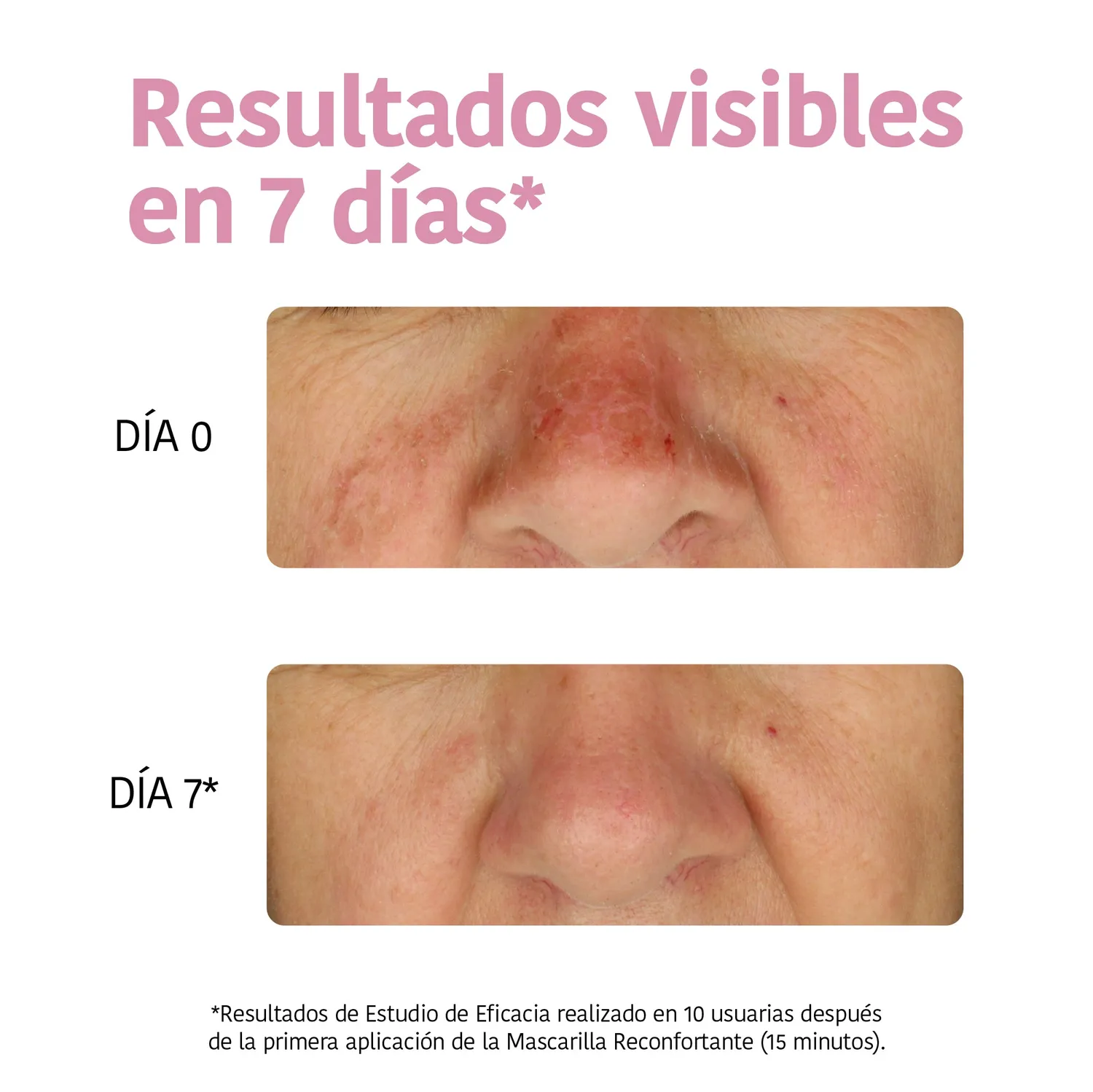 Irohanature Hydrating maschera viso aloe vera idratante lenitiva
