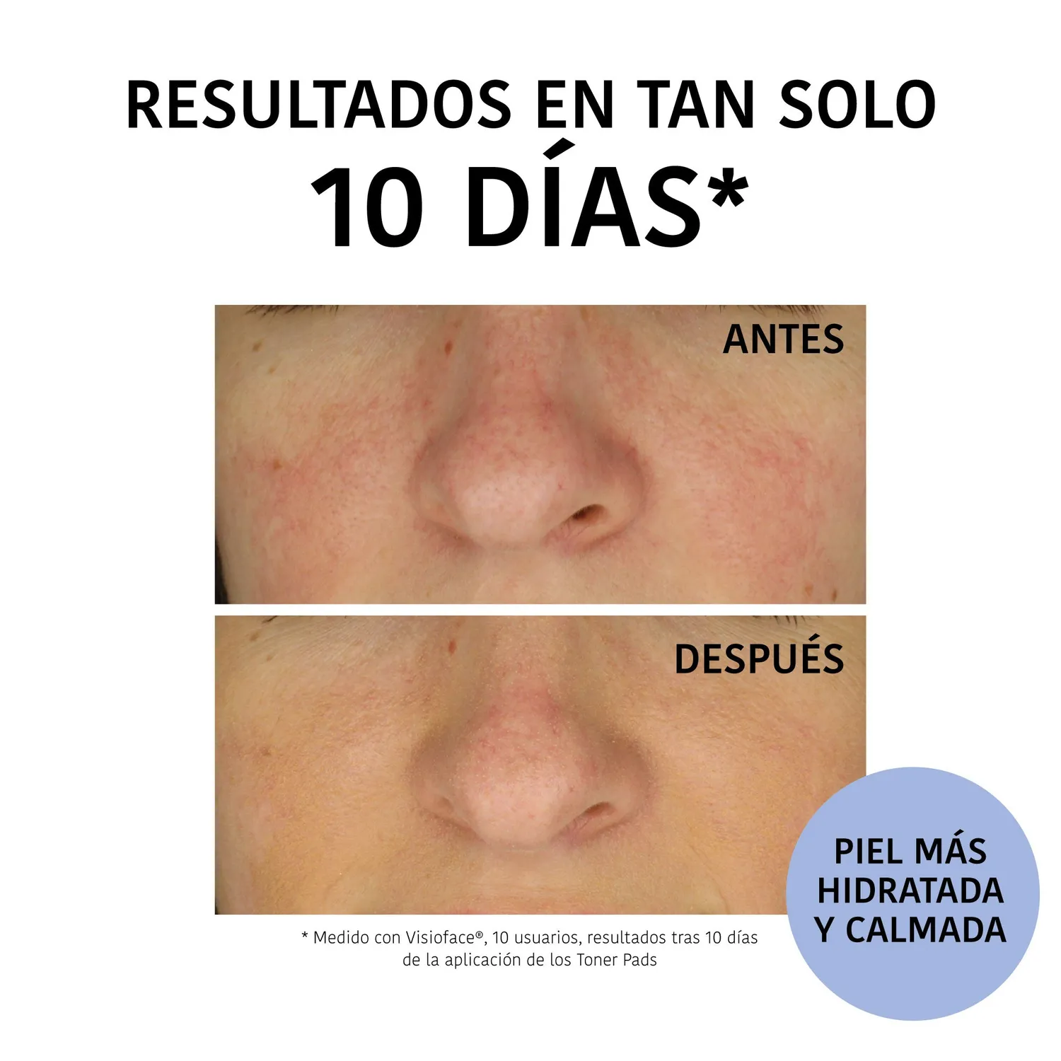 Irohanature Toner Pads Mirtillo Dischetti Tonico Idratanti