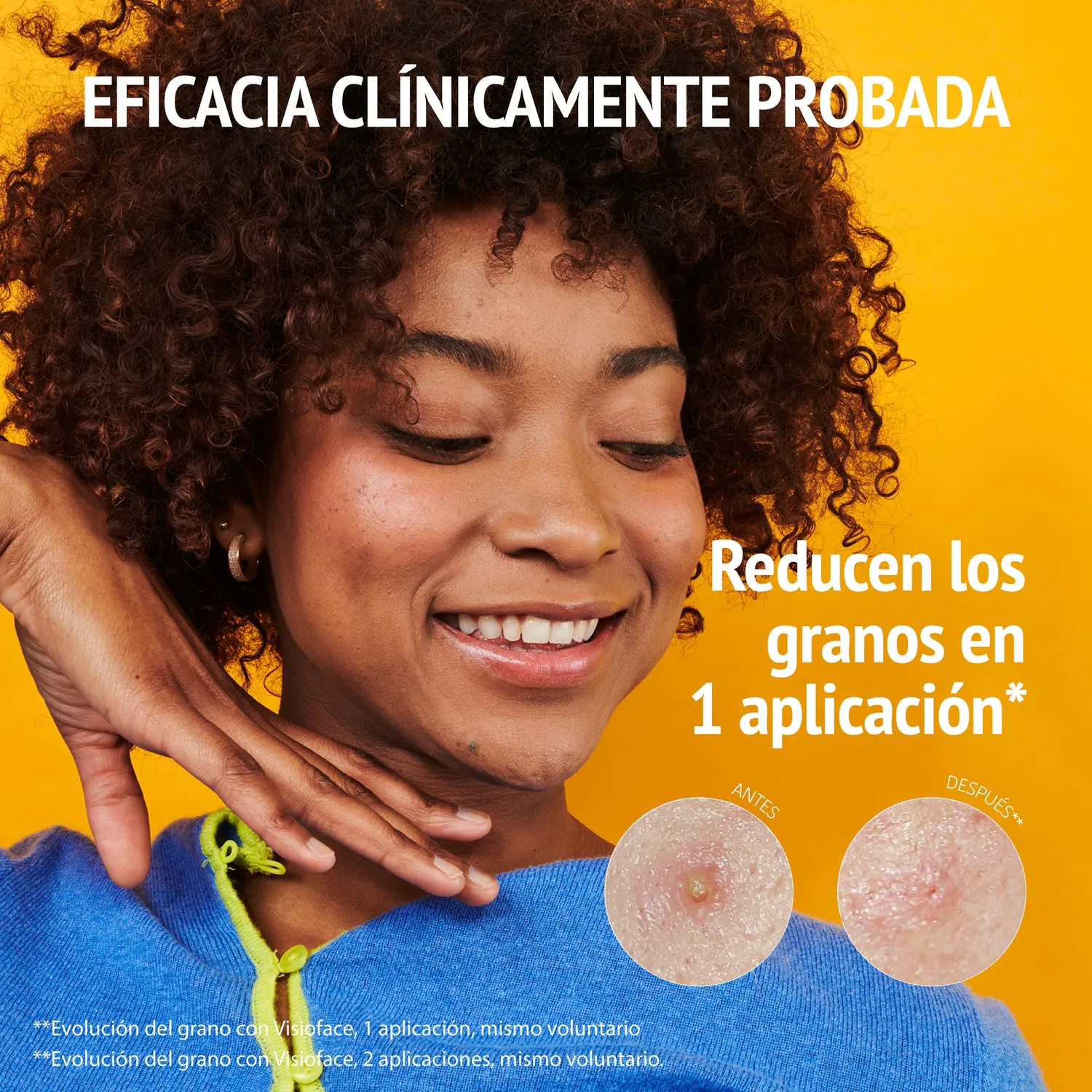 Iroha Nature Pride Patch Brufoli Acido Salicilico Idrocolloidali