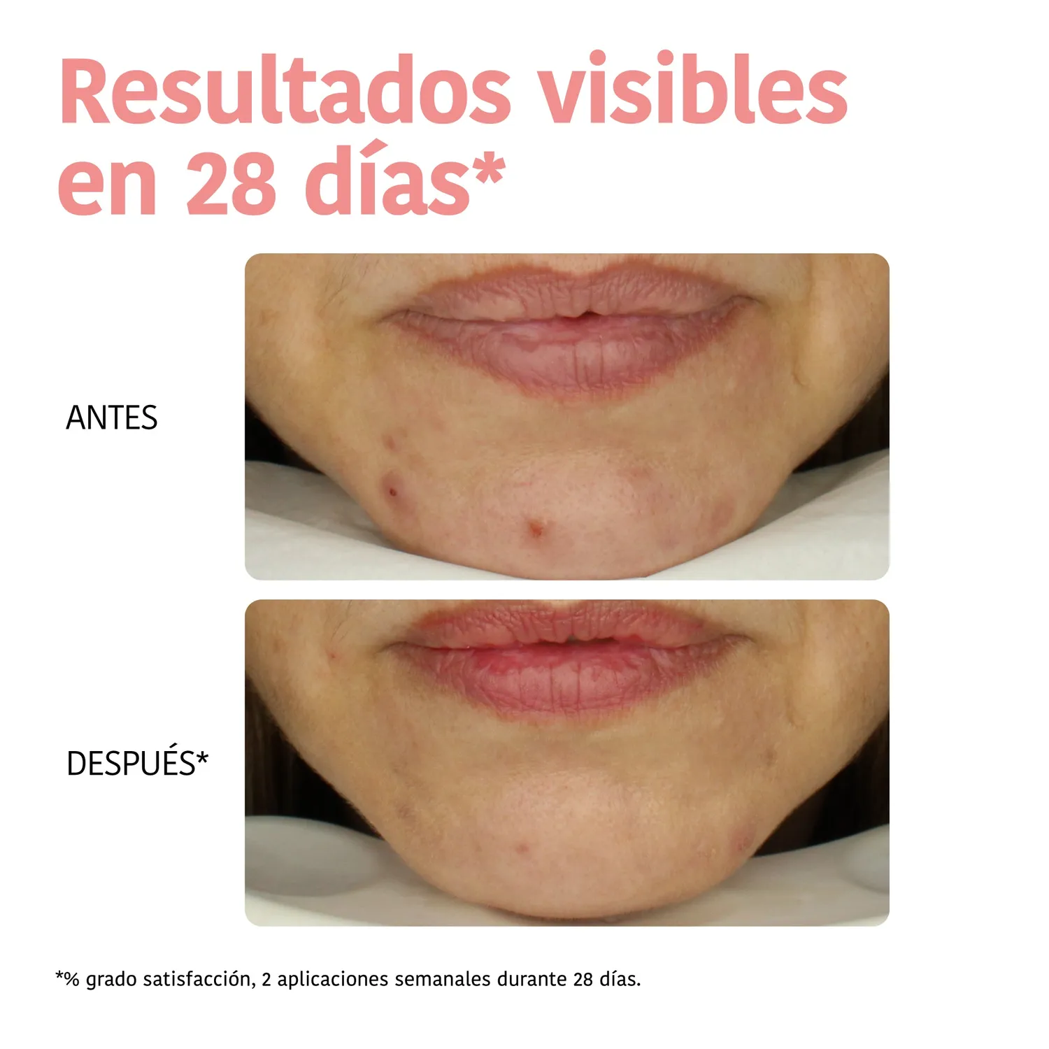 Irohanature Perfect Skin Peeling Mask Acido Glicolico Esfoliante
